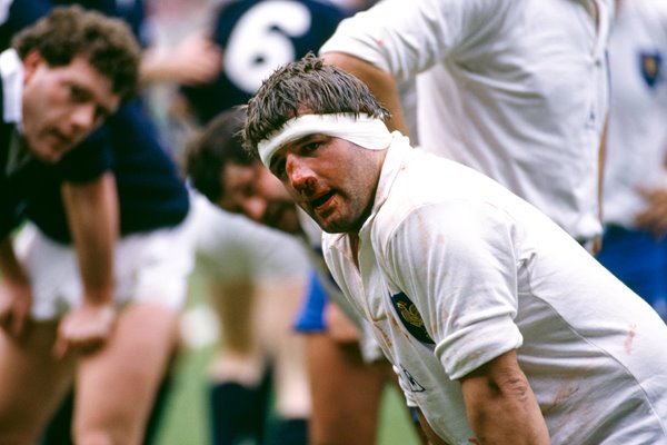 Pascal Ondarts France v Scotland 5 Nations 1987