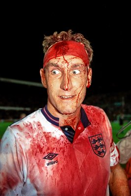 Terry Butcher Blood portrait