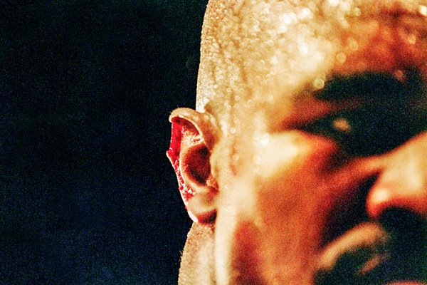 Evander Holyfield Ear v Tyson 1997