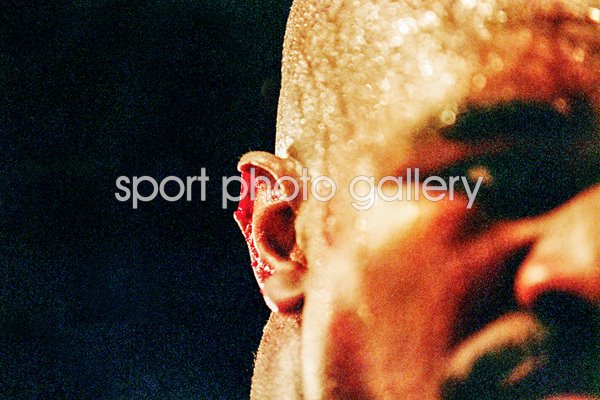 Evander Holyfield Ear v Tyson 1997